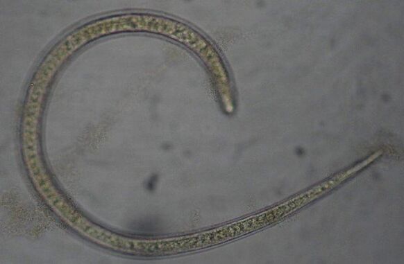 Trichinella to okrągły robak pasożytniczy będący protostomem
