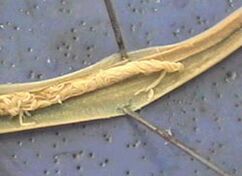 pasożyt