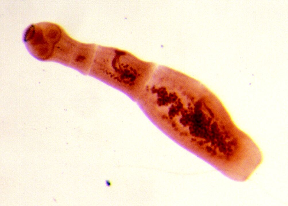 echinokok
